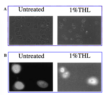Lung Cancer Apoptosis